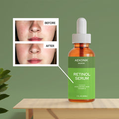 AEKONIK Retinol Serum with Hyaluronic Acid and Vitamin E - 30ML